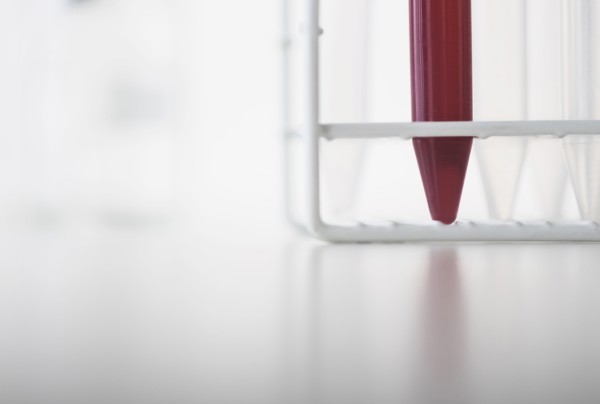 Blood sample in test tube.