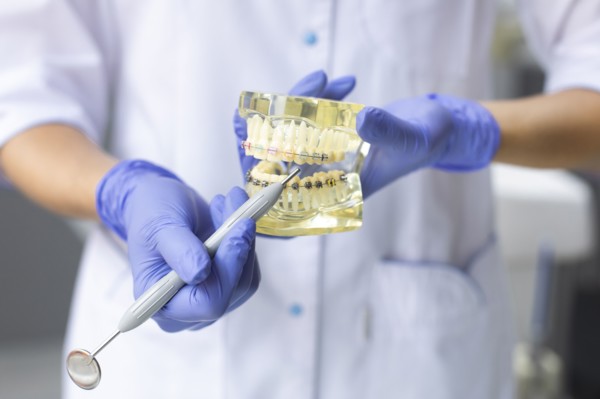 Dental assistant holding model teeth with braces
