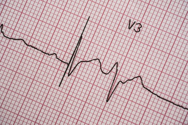 Electrocardiogram on red graph paper