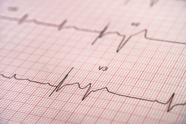 Electrocardiogram on red graph paper