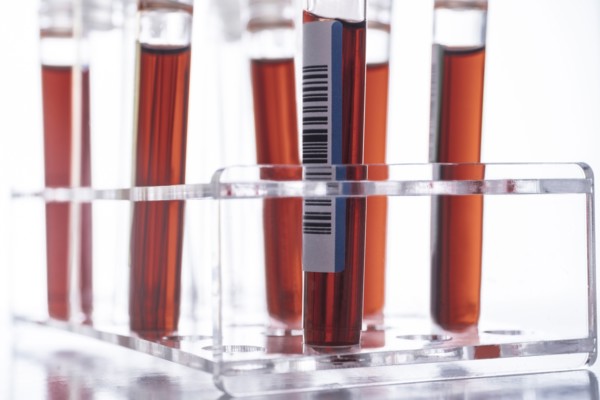 Studio shot of Covid-19 blood samples in test tube rack