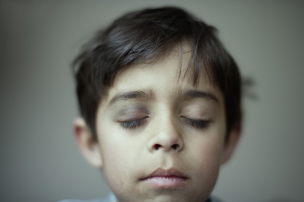 Mixed race boy with black eye