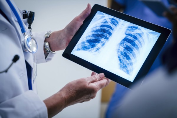 Doctors examining x-ray of chest and ribs on digital tablet