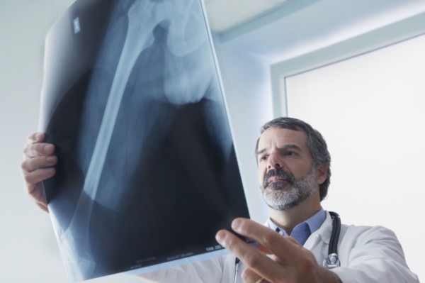 Hispanic doctor examining x-ray