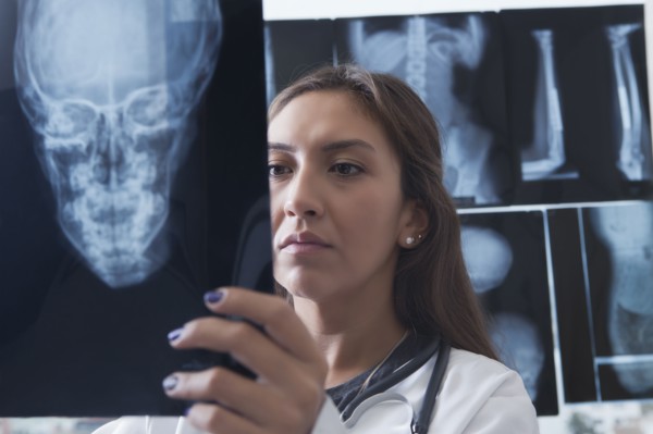 Hispanic doctor examining x-ray of skull