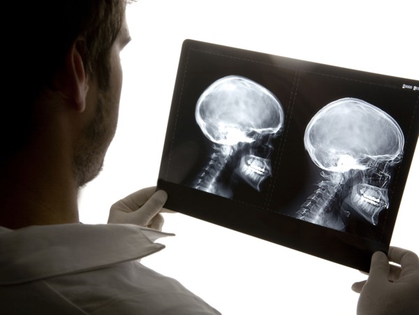 Caucasian doctor examining x-rays in hospital