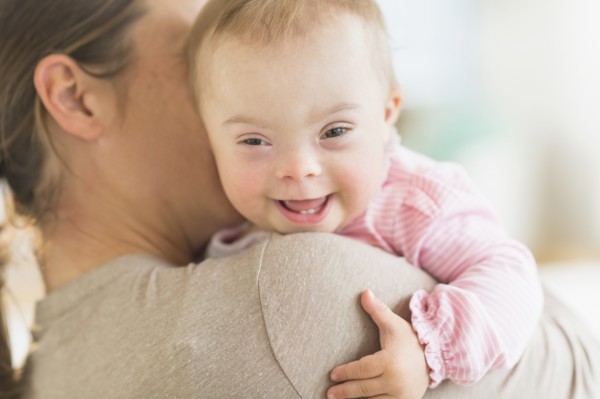 Caucasian mother holding baby girl with Down Syndrome