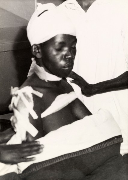Surviving victim of the Lari massacre. A bandaged Kikuyu woman, one of the few survivors of the