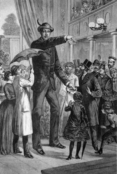 Giant franz winkelmeier