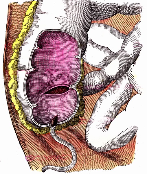 Digestive tract, the caecum or cecum and the appendix ileo cecal. book by dr jules rengade ' life and health ' ,paris 1881