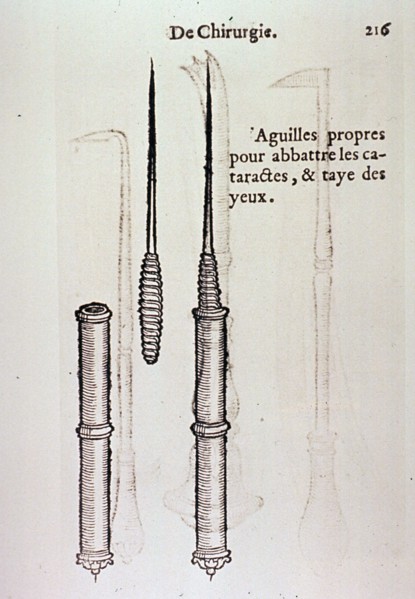 Instruments for cataract removal