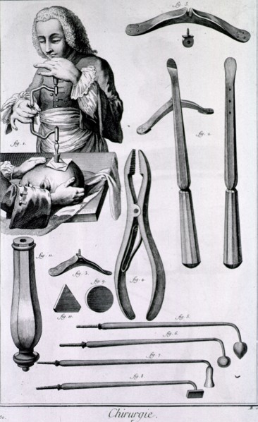 Concernant le tre´pan ca. 1700s