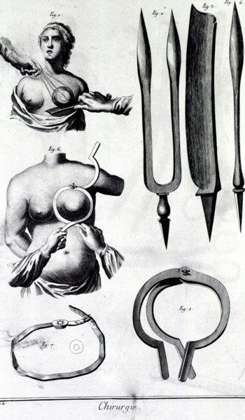 Instruments for breast surgery ca. 1700s