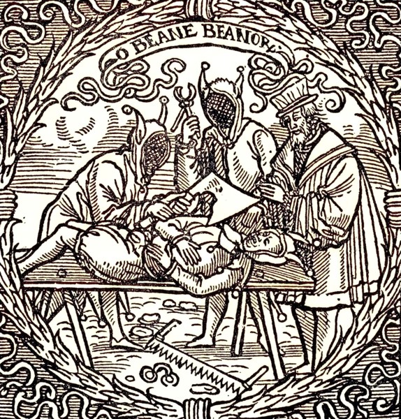 The Deposition