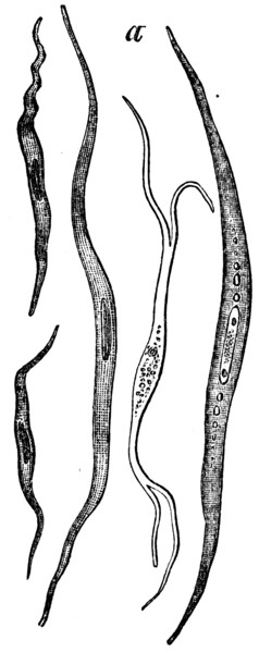 Smooth muscle cells.