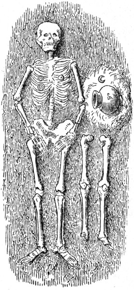 Double grave.