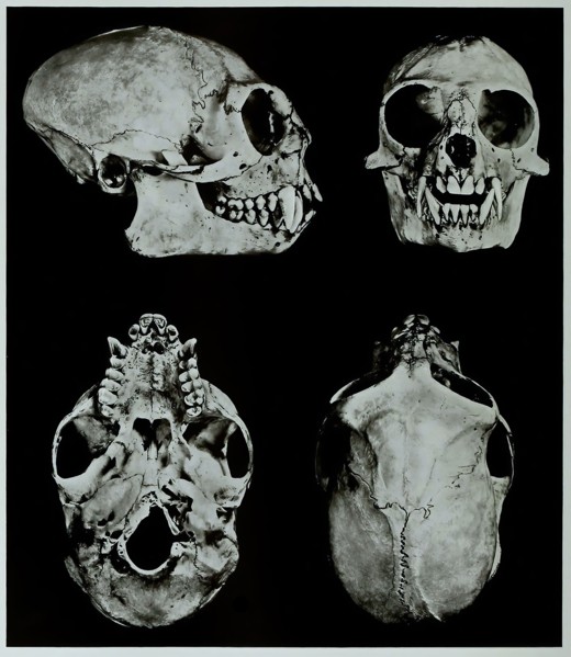 Skull Bones