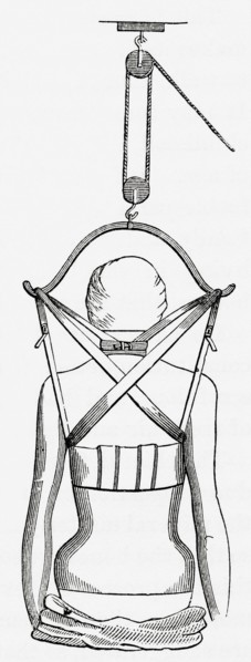 Suspension apparatus for use in spinal disease.