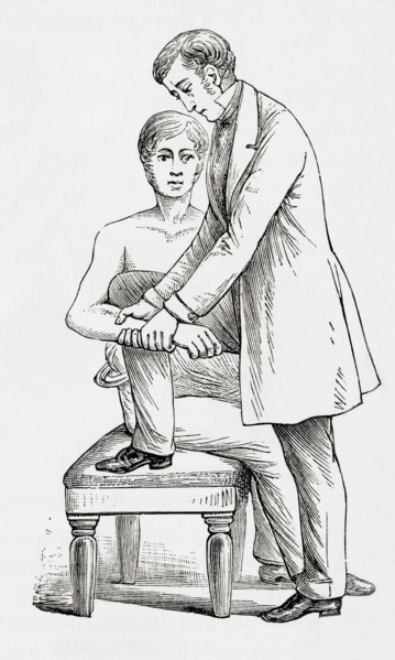 Reduction of dislocation of elbow.