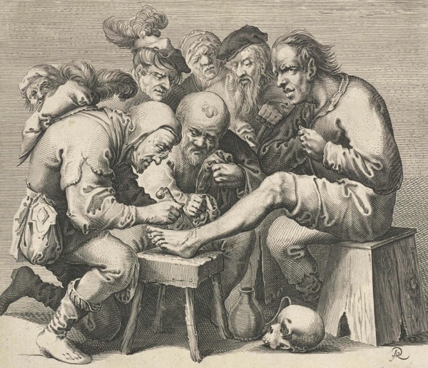 Operation on the foot for teaching purposes by a doctor in the Middle Ages many students are present.
