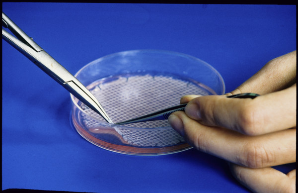 Skin cell culture in petridish 1989