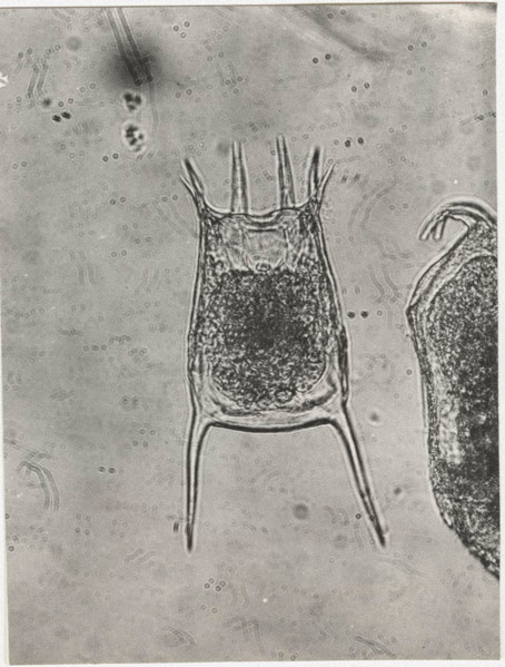 Keratella quadrata