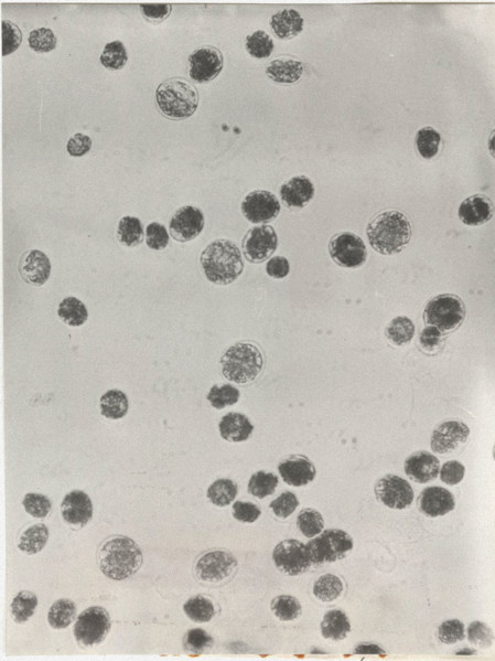 Glenodinium sanguineum