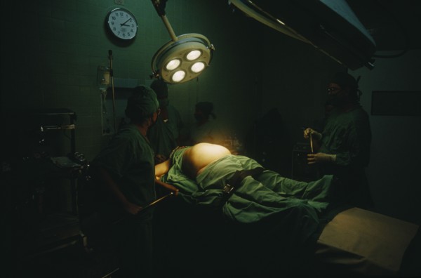 CUBA, Havana, Woman in labour lying on an operating table at the maternity hospital with lamps