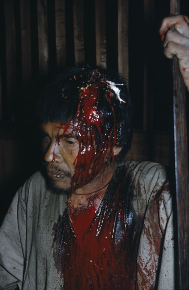 COLOMBIA, Sierra de Perija, Yuko - Motilon ., Victim of bow fight with recent deep wound to skull