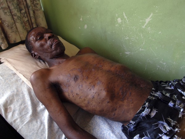 MEDICAL, Disease, HIV, "Africa, Aids victim in bed."