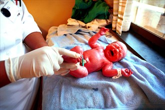 Testing reflexes on a newborn baby