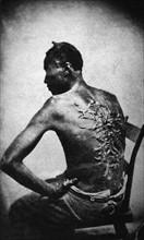 Black African Male with Scars from Whipping 1863 A.D.