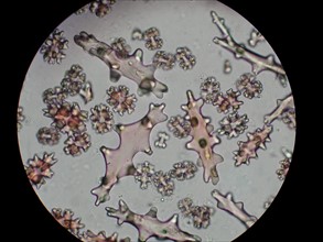 Paragorgia sclerites seen under the microscope