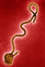 Transmission electron Micrograph of the Ebola Virus Hemorrhagic Fever RNA Virus