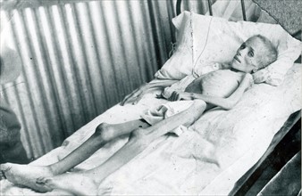 Boer child who died in the Bloemfontein concentration camp in South Africa