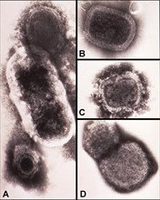 electron micrograph (TEM) revealing some of the ultrastructure morphology exhibited by a number of different microorganisms