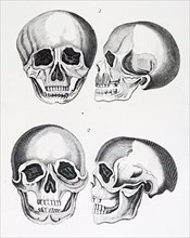 The comparison of human skulls