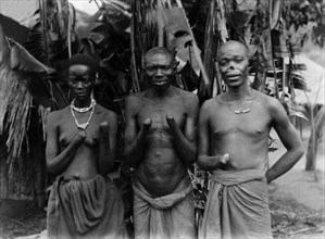 En Afrique, des autochtones ont été mutilés en raison d'une productivité insuffisante, 1907