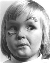 Girl with false eyelash