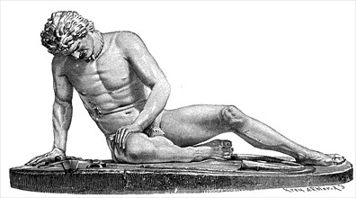 A dying Gaul