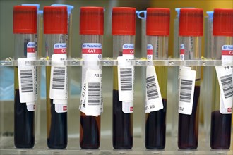 Blood samples in medical laboratory