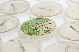Microbiological diagnosis of MRSA bacteria