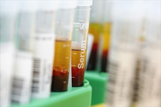 Tubes with blood samples for laboratory study