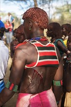 Bloody wound on the back of a woman of the Hamer tribe