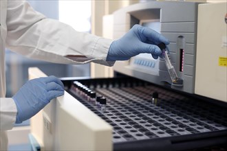 Laboratory testing for tuberculosis