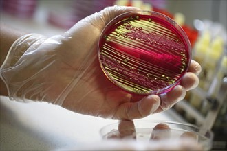 Petri dish with culture medium with bacterial cultures
