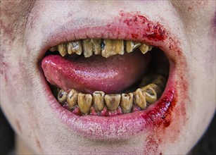 Rotten zombie teeth