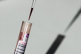 Blood is taken out of a capillary tube using a pipette