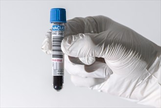 Laboratory assistant's hand holding a monovette containing citrate