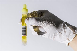 Laboratory assistant's hand holding a monovette containing urine